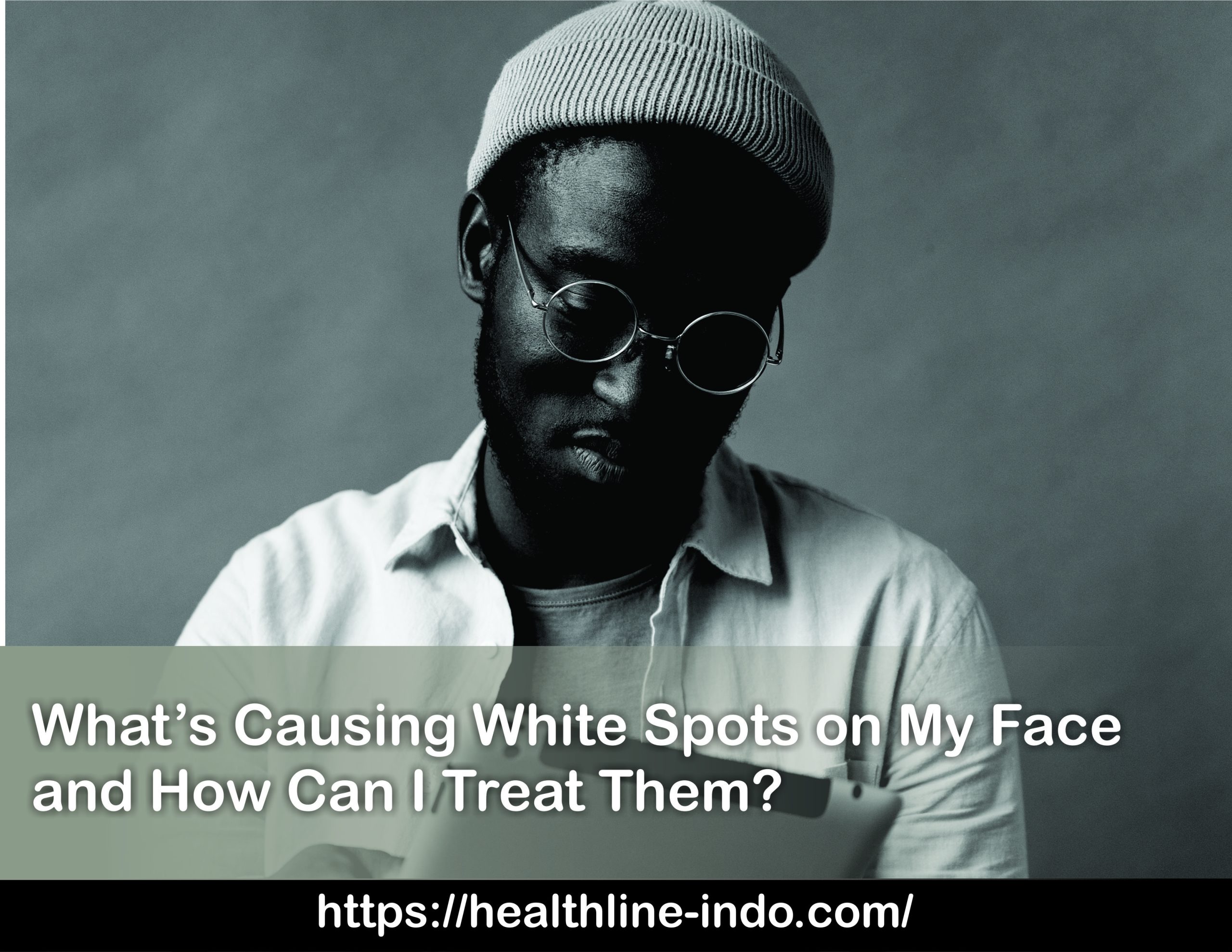 what-s-causing-white-spots-on-my-face-and-how-can-i-treat-them